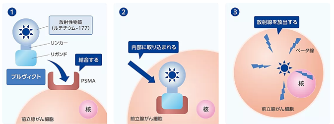放射性リガンド療法イメージ