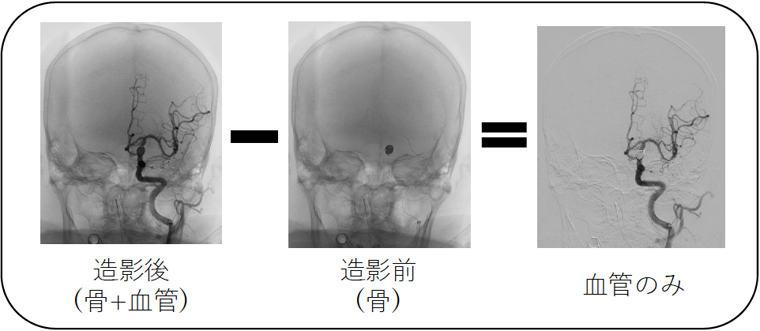 画像：DSAの概要