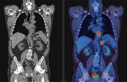 イメージ：ルタテラ